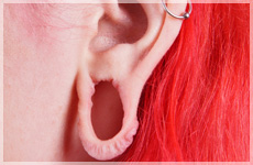 earlobe repair