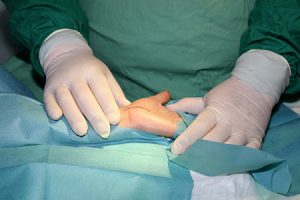 hand and finger surgery